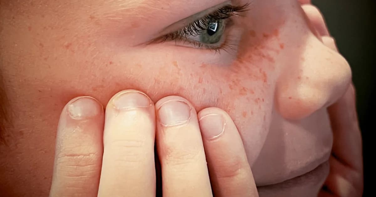 Zinc Deficiency in Children: Signs, Causes, and Treatment